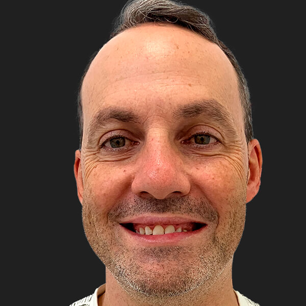 Paciente Jorge antes del tratamiento de ortodoncia invisible con Invisalign en la Clínica dental de Valencia