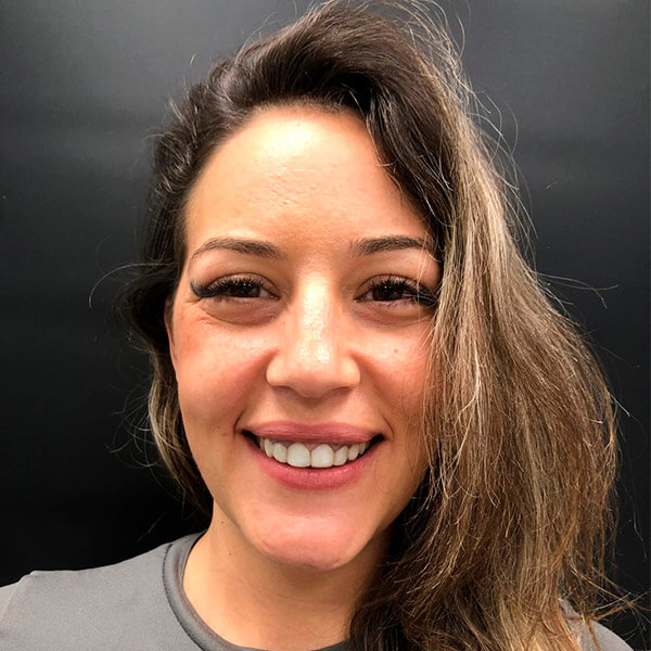 El antes de las carillas dentales de Diana en la Clínica dental de Valencia