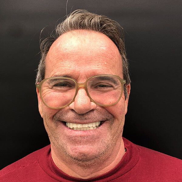 Después de la rehabilitación oral completa con implantes dentales y prótesis del paciente Vicente